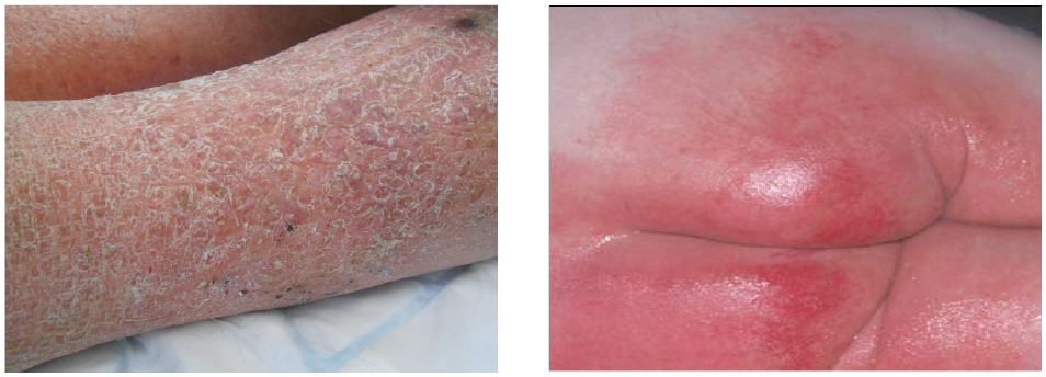 CPP_WH_drymoistskin 954x330.png